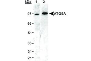 Western blot analysis of ATG9A in 293 cell lysates using ATG9A polyclonal antibody . (ATG9A antibody  (AA 750-839))