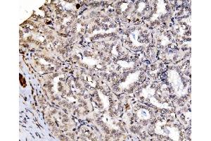IHC analysis of RAX2 using anti-RAX2 antibody (ABIN7602913).
