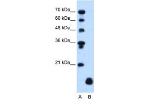 WB Suggested Anti-PLP2 Antibody Titration:  1. (PLP2 antibody  (Middle Region))