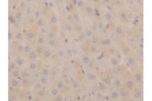 Detection of NPPA in Rat Liver Tissue using Polyclonal Antibody to Natriuretic Peptide Precursor A (NPPA) (NPPA antibody  (AA 25-152))