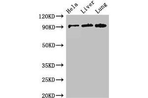 CPT1C antibody  (AA 699-803)