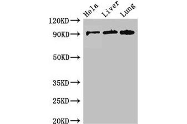 CPT1C antibody  (AA 699-803)