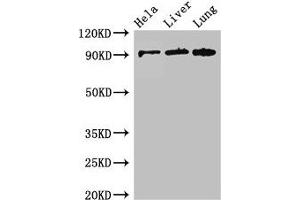 Western Blot Positive WB detected in: Hela whole cell lysate, Mouse liver tissue, Mouse lung tissue All lanes: CPT1C antibody at 2.
