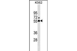 ESR2 Antibody (Center)(Ascites) ABIN1537698 western blot analysis in K562 cell line lysates (35 μg/lane). (ESR2 antibody  (AA 369-397))