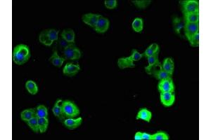 Immunofluorescent analysis of A431 cells using ABIN7159336 at dilution of 1:100 and Alexa Fluor 488-congugated AffiniPure Goat Anti-Rabbit IgG(H+L)
