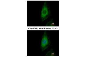 ICC/IF Image Immunofluorescence analysis of paraformaldehyde-fixed HeLa, using PP2A beta, antibody at 1:500 dilution. (PPP2CB antibody  (Center))