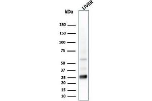 Western Blot Analysis of liver tissue lysate using GSTMu2 Mouse Monoclonal Antibody (CPTC-GSTMu2-2). (GSTM4 antibody)