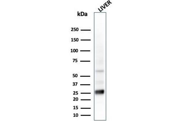 GSTM4 antibody