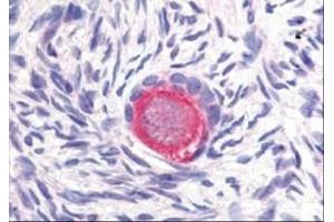 Image no. 1 for anti-delta-Like 4 (DLL4) (Internal Region) antibody (ABIN199951) (DLL4 antibody  (Internal Region))