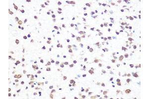 Immunohistochemistry of paraffin-embedded rat brain using THOC4/THOC4/ALYREFREF Rabbit mAb (ABIN1679512, ABIN3018793, ABIN3018794 and ABIN7101662) at dilution of 1:100 (40x lens). (THO Complex 4 antibody)