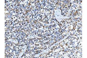 IHC analysis of TRK fused gene/TFG using anti-TRK fused gene/TFG antibody (ABIN7599839). (TFG antibody  (AA 121-400))