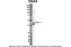 Sample Type: Nthy-ori cell lysate (50ug)Primary Dilution: 1:1000Secondary Antibody: anti-rabbit HRPSecondary Dilution: 1:2000Image Submitted By: Anonymous (GNAS antibody  (N-Term))