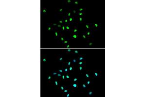 Immunofluorescence analysis of A549 cell using HDAC1 antibody. (HDAC1 antibody  (AA 393-482))