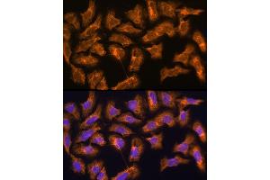 Immunofluorescence (IF) image for anti-Small Proline-Rich Protein 3 (SPRR3) (AA 1-70) antibody (ABIN6148386)