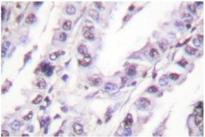 Image no. 1 for anti-X-Ray Repair Complementing Defective Repair in Chinese Hamster Cells 5 (Double-Strand-Break Rejoining) (XRCC5) antibody (ABIN271897) (XRCC5 antibody)