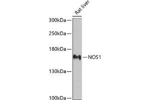 Western blot analysis of extracts of rat liver, using NOS1 antibody (ABIN3022008, ABIN3022009, ABIN3022010 and ABIN6218566) at 1:2000 dilution. (NOS1 antibody  (AA 1-180))