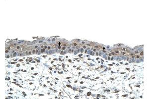 CENPA antibody was used for immunohistochemistry at a concentration of 4-8 ug/ml to stain Squamous epithelial cells (arrows) in Human Skin. (CENPA antibody  (N-Term))