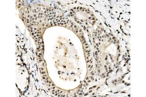 IHC analysis of JUNB using anti-JUNB antibody (ABIN7603223).