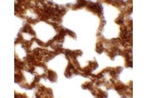 Immunohistochemistry of NETO1 in rat lung tissue with NETO1 antibody at 2. (NETO1 antibody  (C-Term))