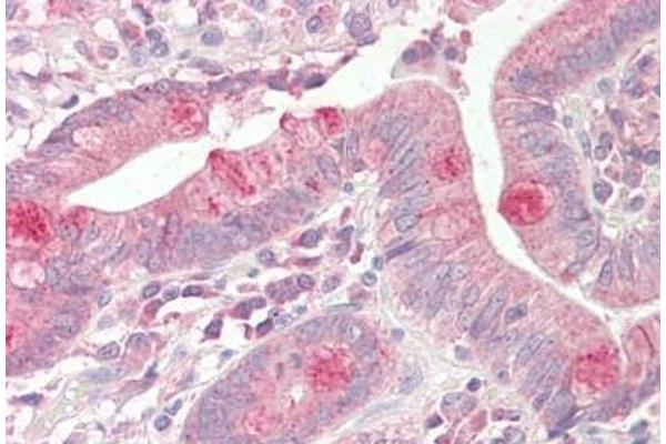 VAMP7 antibody  (N-Term)