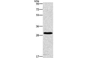 Western blot analysis of Hela cell, using BCL10 Polyclonal Antibody at dilution of 1:950 (BCL10 antibody)