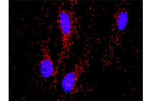 Proximity Ligation Analysis of protein-protein interactions between PITX2 and CTNNB1. (PITX2 antibody  (AA 1-271))