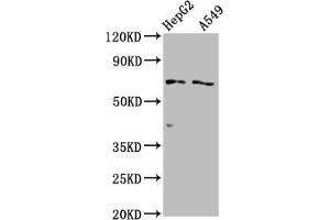 Western Blot Positive WB detected in: HepG2 whole cell lysate, A549 whole cell lysate All lanes: SLCO1B1 antibody at 1:2000 Secondary Goat polyclonal to rabbit IgG at 1/50000 dilution Predicted band size: 77 kDa Observed band size: 77 kDa (SLCO1B1 antibody  (AA 426-537))