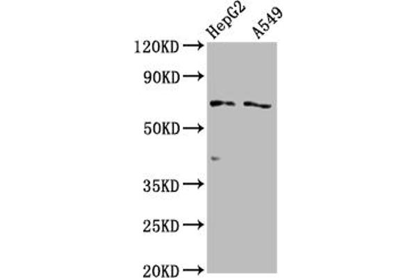 SLCO1B1 anticorps  (AA 426-537)