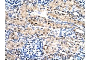 SULF2 antibody was used for immunohistochemistry at a concentration of 4-8 ug/ml to stain Epithelial cells of renal tubule (arrows) in Human Kidney.