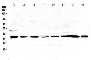 Western blot analysis of Thrombopoietin using anti-Thrombopoietin antibody .