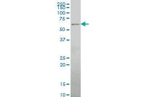 ALG6 monoclonal antibody (M09), clone 2G11 Western Blot analysis of ALG6 expression in Hela S3 NE . (ALG6 antibody  (AA 25-114))