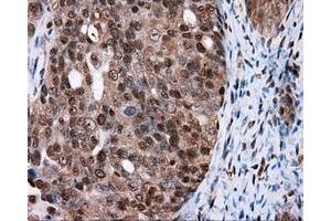 Immunohistochemical staining of paraffin-embedded colon tissue using anti-FAHD2A mouse monoclonal antibody. (FAHD2A antibody)