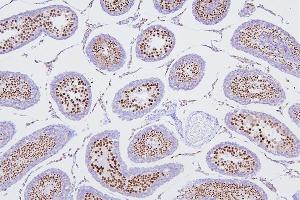 IHC analysis of DR1 using anti-DR1 antibody (ABIN7602313).