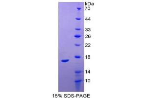SDS-PAGE (SDS) image for Midkine (Neurite Growth-Promoting Factor 2) (MDK) (AA 22-143) protein (His tag) (ABIN1980799)