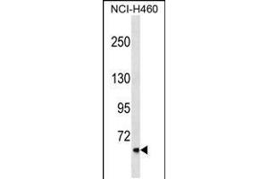 Western blot analysis in NCI-H460 cell line lysates (35ug/lane). (CLCNKA antibody  (N-Term))