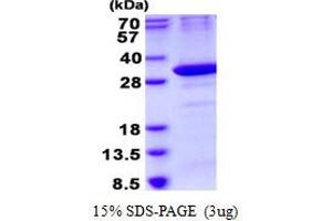 Image no. 1 for Ornithine Decarboxylase Antizyme 1 (OAZ1) protein (His tag) (ABIN1098382)