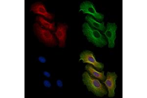 ABIN6256556 and ABIN6267493 staining H2O2 treated Hela cells by IF/ICC. (MEK2 antibody  (pThr394))