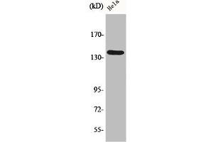 Western Blot analysis of HepG2 cells using DDX8 Polyclonal Antibody (DHX8 antibody  (Internal Region))