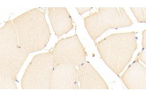 Immunohistochemistry (IHC) image for anti-Parkinson Protein 7 (PARK7) (AA 1-189) antibody (ABIN7436813)