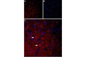 Expression of Serotonin receptor 3A in rat brain - Immunohistochemical staining of rat parietal cortex using Anti-5HT3A Receptor (HTR3A) Antibody (ABIN7043621, ABIN7045283 and ABIN7045284), (1:400), (red). (Serotonin Receptor 3A antibody  (2nd Cytoplasmic Loop))