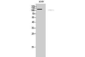 Western Blotting (WB) image for anti-Splicing Factor, Arginine/serine-Rich 14 (SFRS14) (Internal Region) antibody (ABIN3186925) (SFRS14 antibody  (Internal Region))