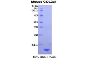 SDS-PAGE (SDS) image for Collagen, Type II, alpha 1 (COL2A1) (AA 1307-1383) protein (His tag) (ABIN1981123)