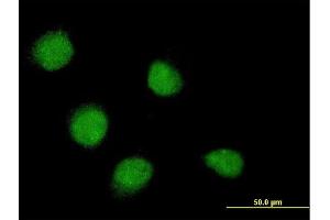 Immunofluorescence of monoclonal antibody to SSX4 on HeLa cell. (SSX4 antibody  (AA 91-188))