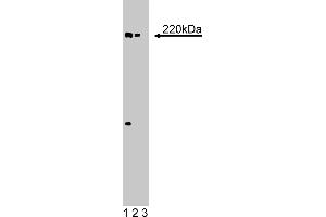 Western Blotting (WB) image for anti-eIF-4gamma (AA 1217-1386) antibody (ABIN968023) (eIF-4gamma (AA 1217-1386) antibody)