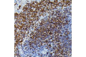 Immunohistochemistry of paraffin-embedded rat spleen using Apolipoprotein C3 antibody (ABIN7265641) at dilution of 1:100 (40x lens). (APOC3 antibody  (AA 1-99))