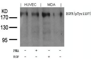 Image no. 1 for anti-Epidermal Growth Factor Receptor (EGFR) (pTyr1197) antibody (ABIN401613) (EGFR antibody  (pTyr1197))