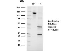 SDS-PAGE Analysis Purified Growth Hormone Mouse Monoclonal Antibody (GH/3155). (Growth Hormone 1 antibody)