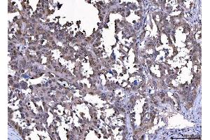 IHC analysis of Cdk2 using anti-Cdk2 antibody (ABIN7602523). (CDK2 antibody  (AA 81-298))