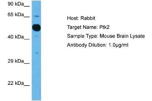 Host: Mouse Target Name: PTK2 Sample Tissue: Mouse Brain Antibody Dilution: 1ug/ml (FAK antibody  (Middle Region))