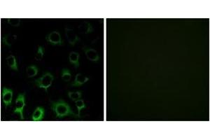 Immunofluorescence analysis of HuvEc cells, using RPS4X Antibody. (RPS4X antibody  (AA 81-130))